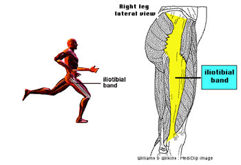 The iliotibial band and site of injury at lateral epicondyle of